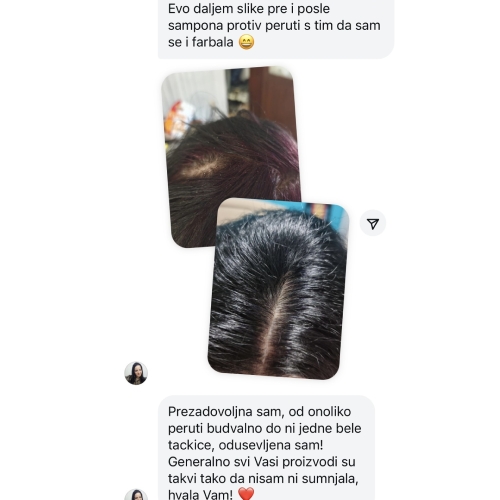 dandruf Å¡amp